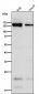 Anti-CD21 CR2 Rabbit Monoclonal Antibody